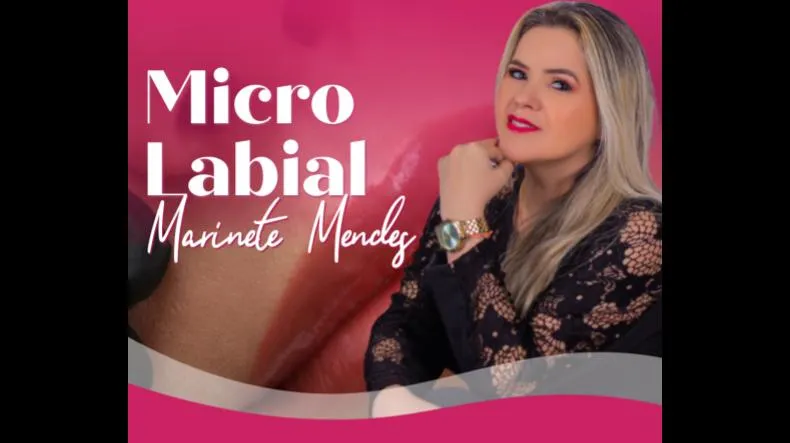 Micro Labial Marinete Mendes é bom? Micro Labial Marinete Mendes posso confiar?